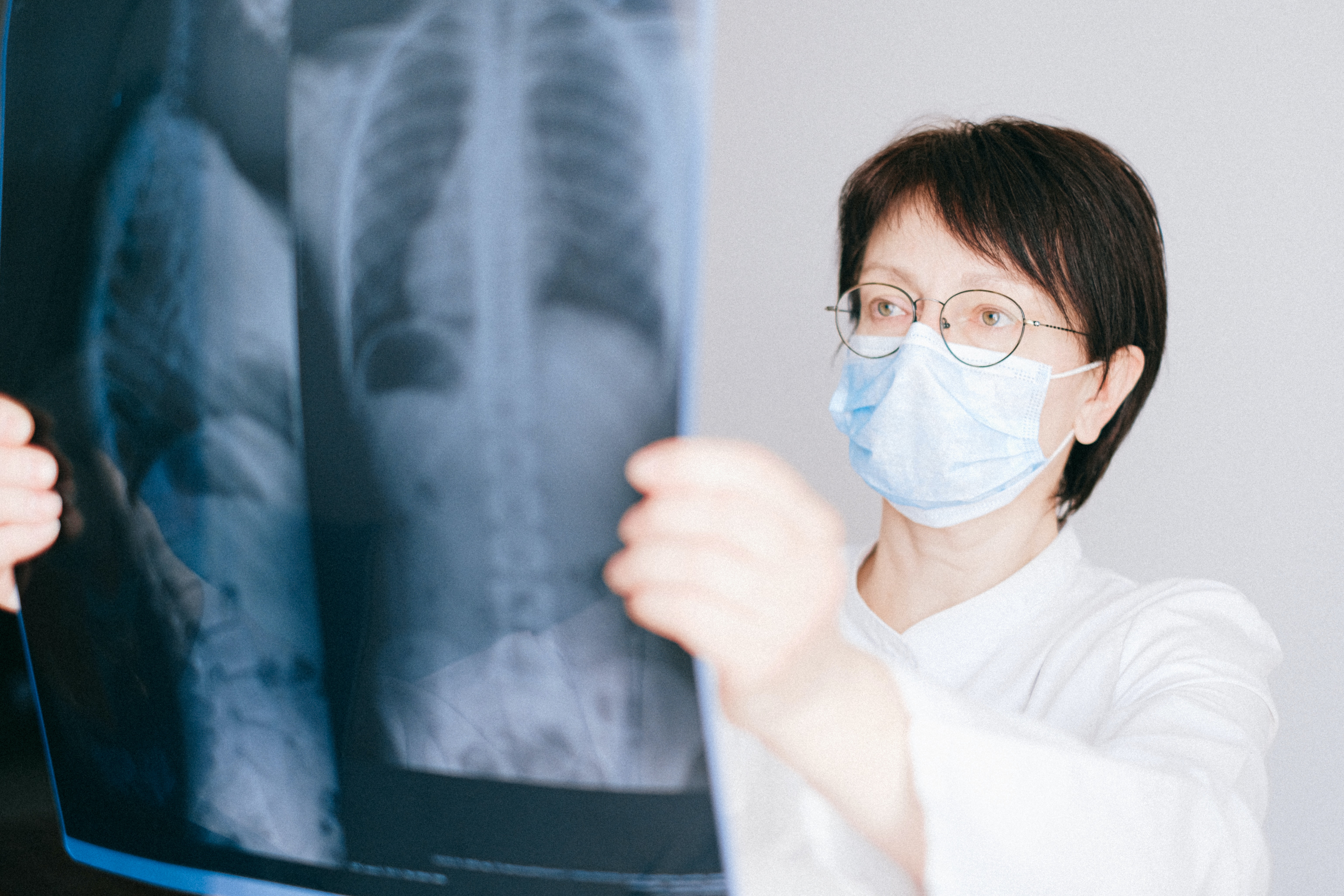 Médica de máscara segurando uma Radiografia